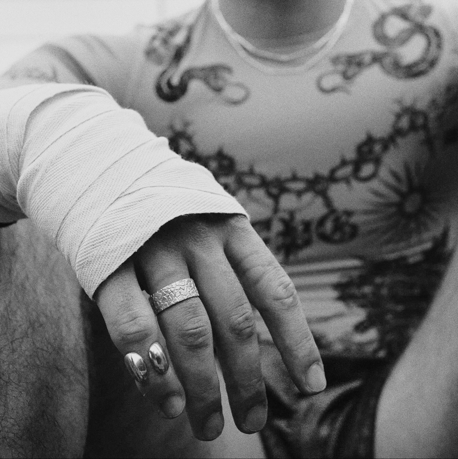 Person with tattoos wearing a ring and bandaged hand.