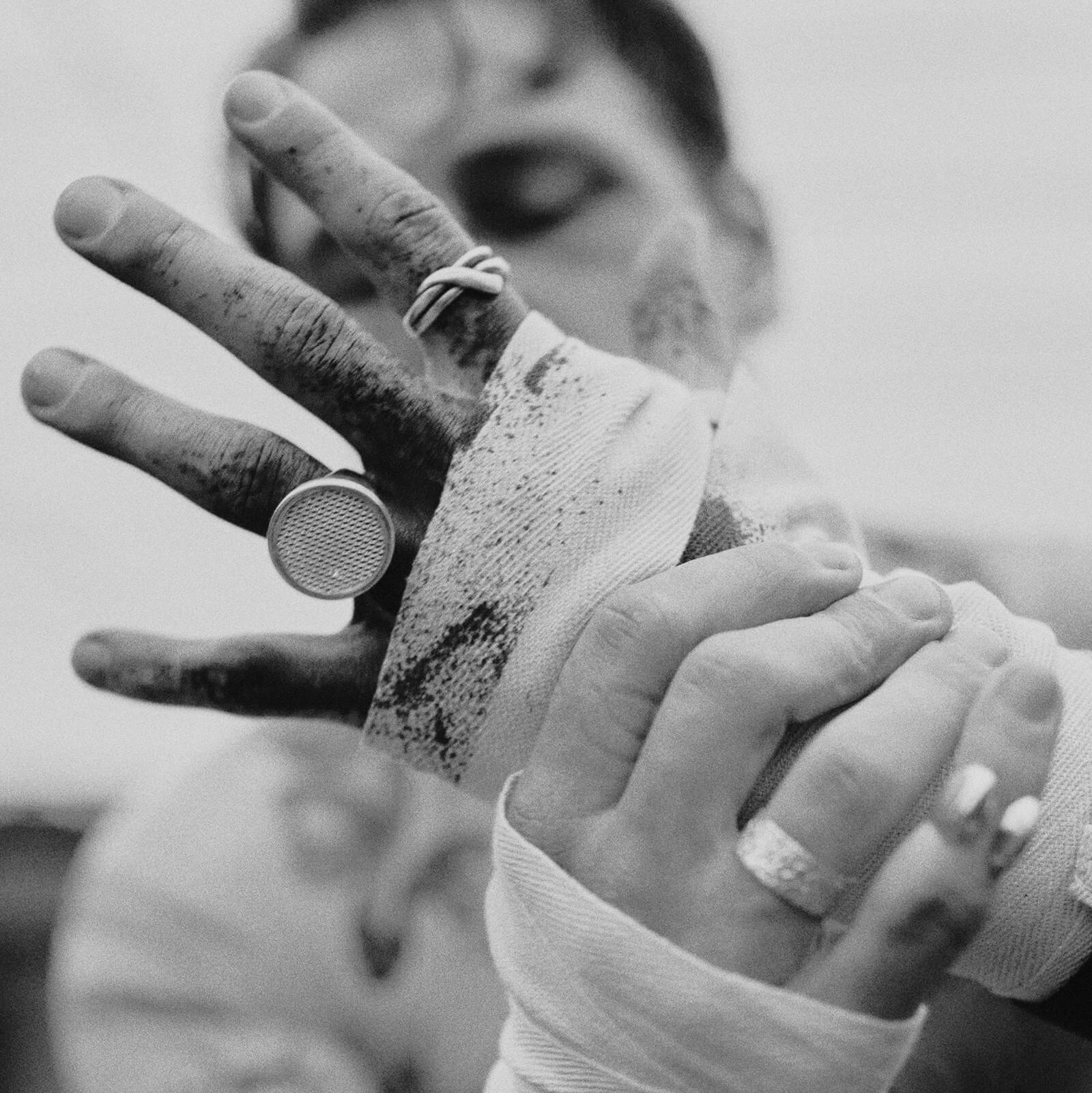 Person with bandaged hands and a ring, with a blurred background